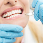 Closeup of a woman smiling as blue gloved hands hold a dental mirror during her dental cleaning