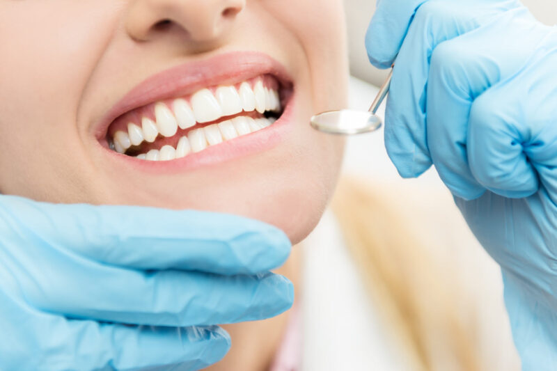 Closeup of a woman smiling as blue gloved hands hold a dental mirror during her dental cleaning