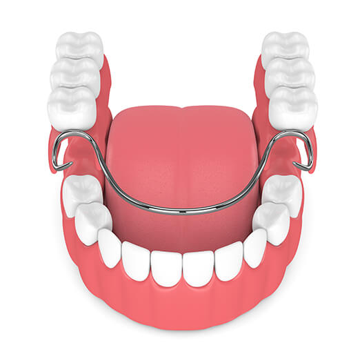 illustration of partial dentures